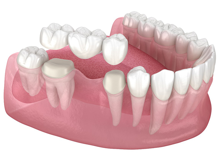 Crescent Family and Cosmetic Dentistry of Columbia
